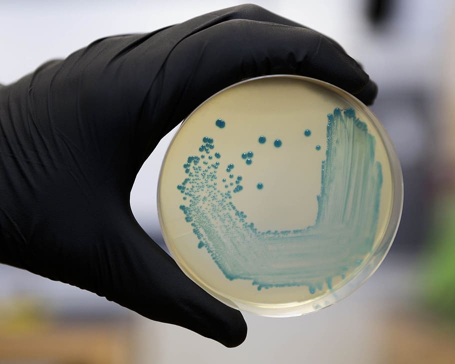 Food safety pathogen Listeria monocytogenes isolated on agar from a food sample., HD wallpaper