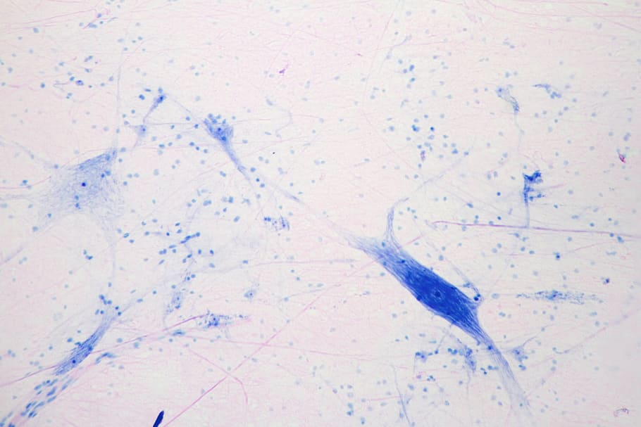 Microscope view of giant multipolar neuron, axon, dendrites, central