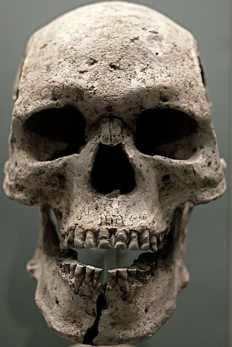 close-up, bone, human skeleton, human skull, human body part HD wallpaper