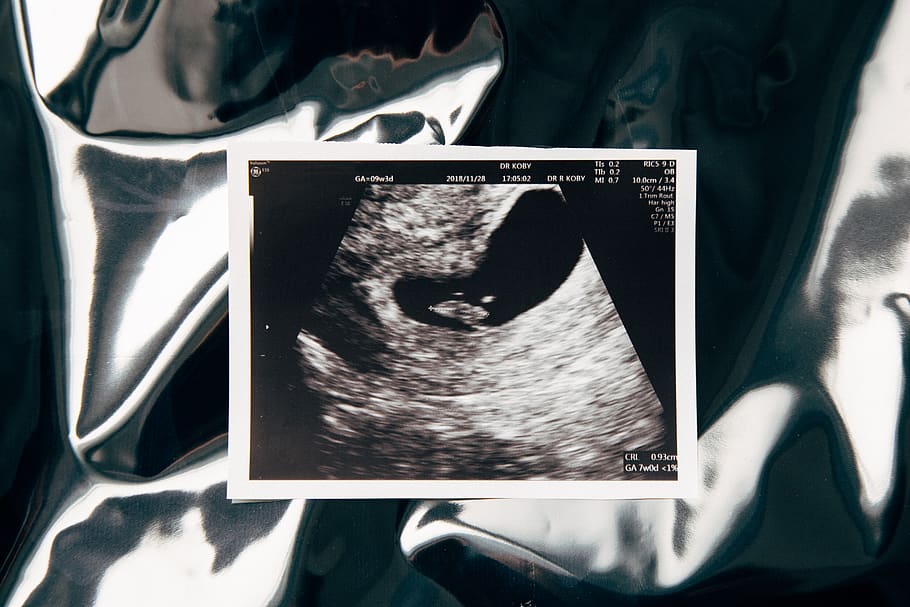 pregnant test illustration, poster, advertisement, collage, apparel HD wallpaper