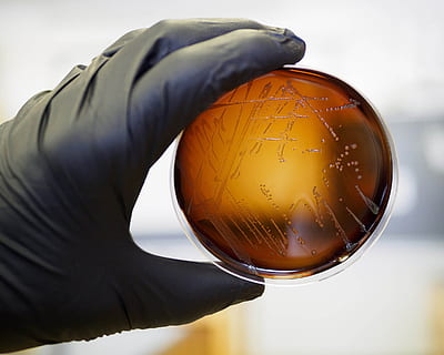 Food safety pathogen Listeria monocytogenes isolated on agar from a food sample. HD wallpaper
