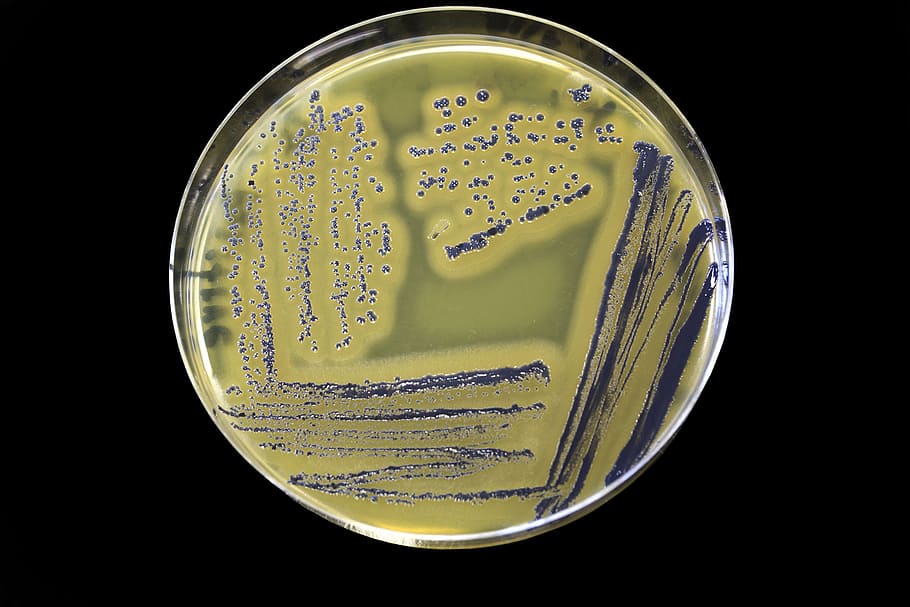 Food safety bacteria pathogenStaphylococcus aureus growing on Baird Parker agar with egg yolk and tellurite.
