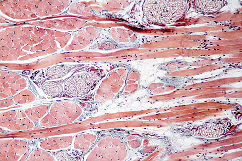 skeletal muscle tissue slide 100x