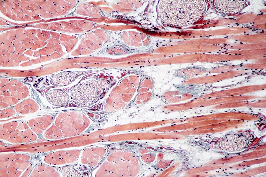 Fixed slide cross section of muscle tissue, 100x microscope view
