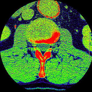 catscan, image, aaa, spine, color, medical, pain, hospital HD wallpaper