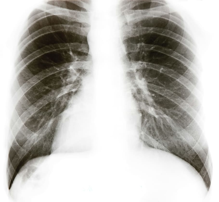 Cool X Ray Wallpaper 66 images