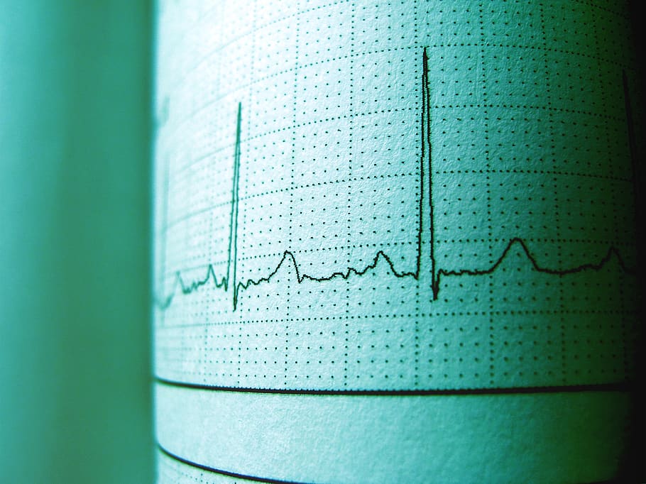 Wavelength, analysis, cardiogram, diagnosis, ecg, electrocardiogram