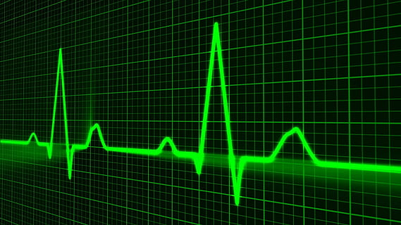 trace, pulse, beat, green, graphical, green color, healthcare and medicine HD wallpaper
