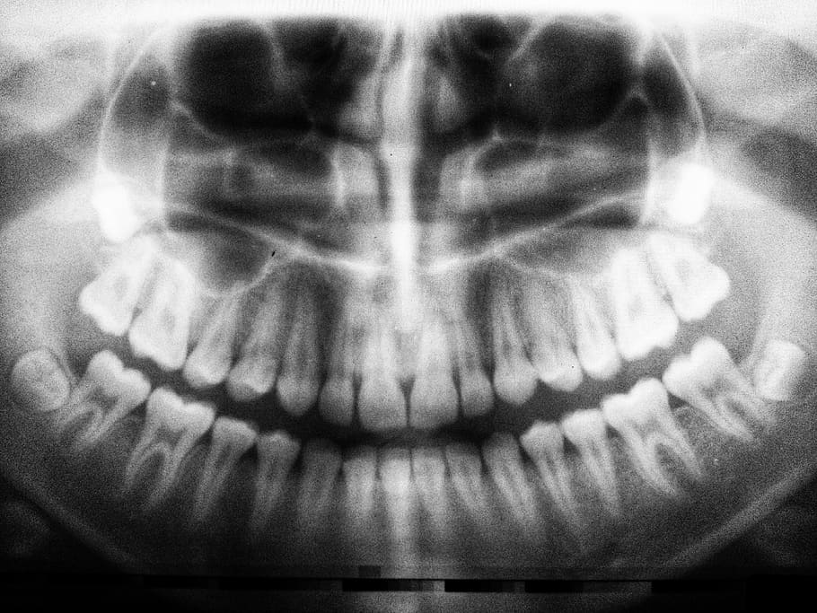 teeth X-ray, one person, human body part, close-up, front view HD wallpaper