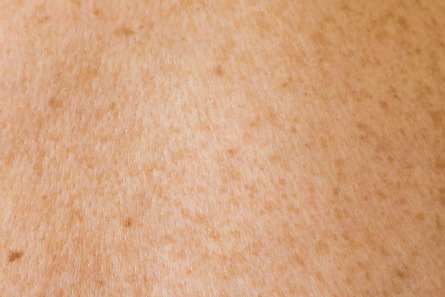 skin texture, mole, spot, freckles, human skin, backgrounds, HD wallpaper