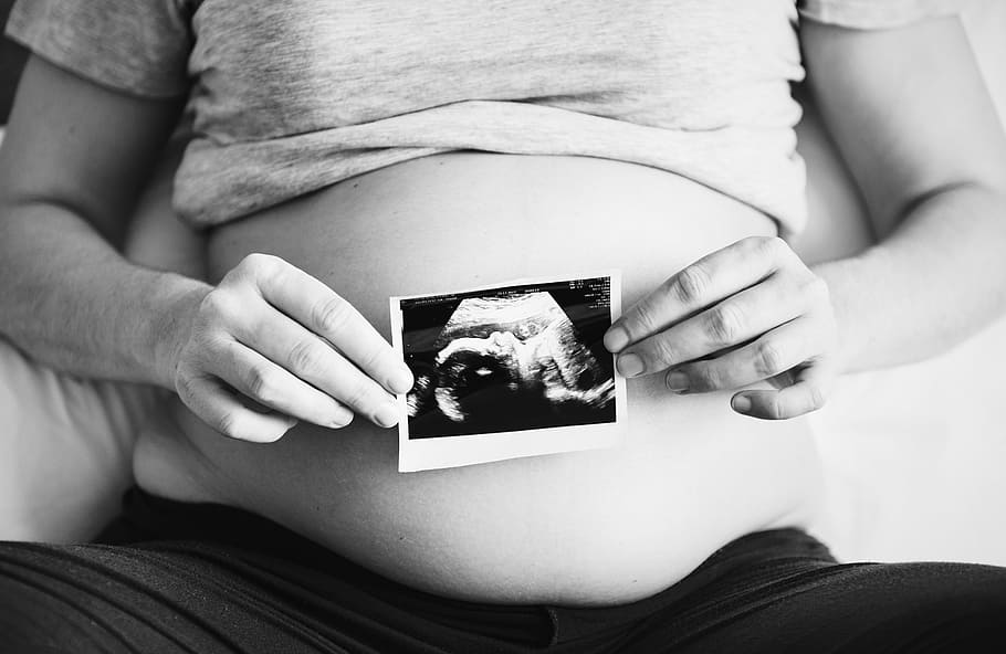 Grayscale Photography of Woman Holding Ultrasound Photo, abdomen, HD wallpaper